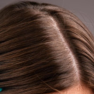 importancia del cuero cabelludo